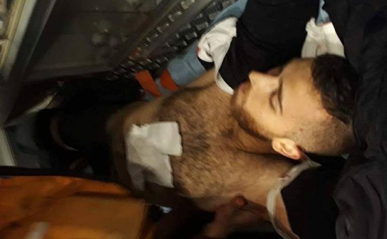 شهيد وعشرات الجرحى بمواجهات عنيفة مع الاحتلال شمال نابلس